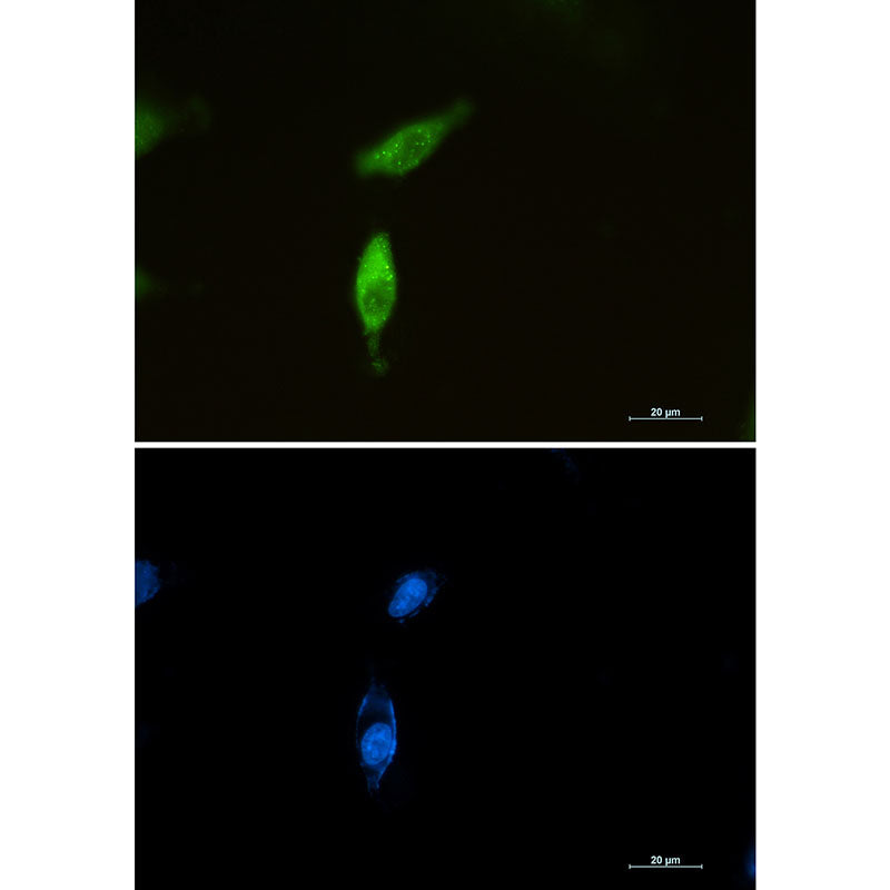 SQSTM1/p62 Rabbit Monoclonal Antibody