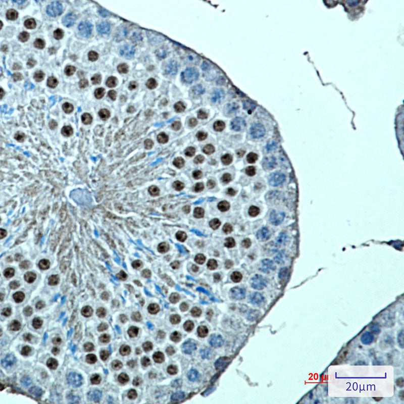 KMT4 Rabbit Monoclonal Antibody