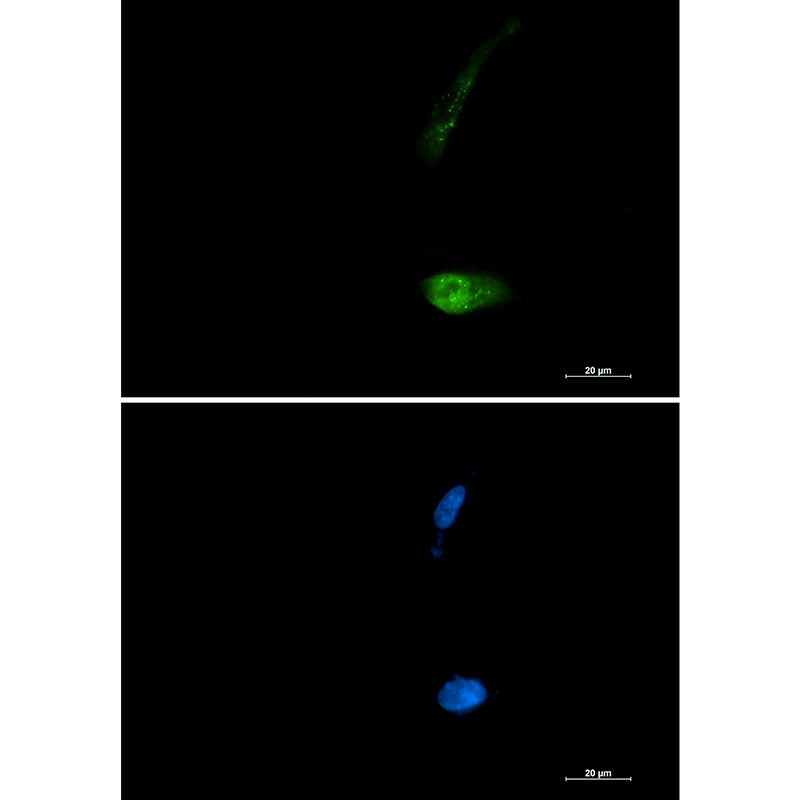 SQSTM1/p62 Rabbit Monoclonal Antibody