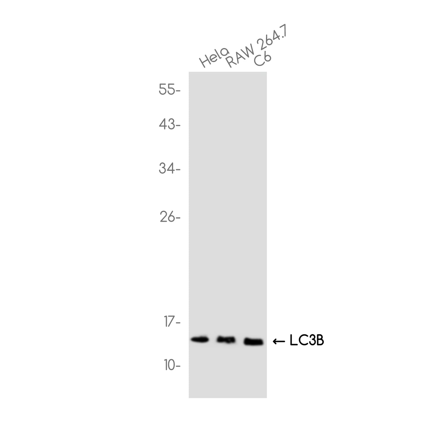 LC3B Rabbit Monoclonal Antibody