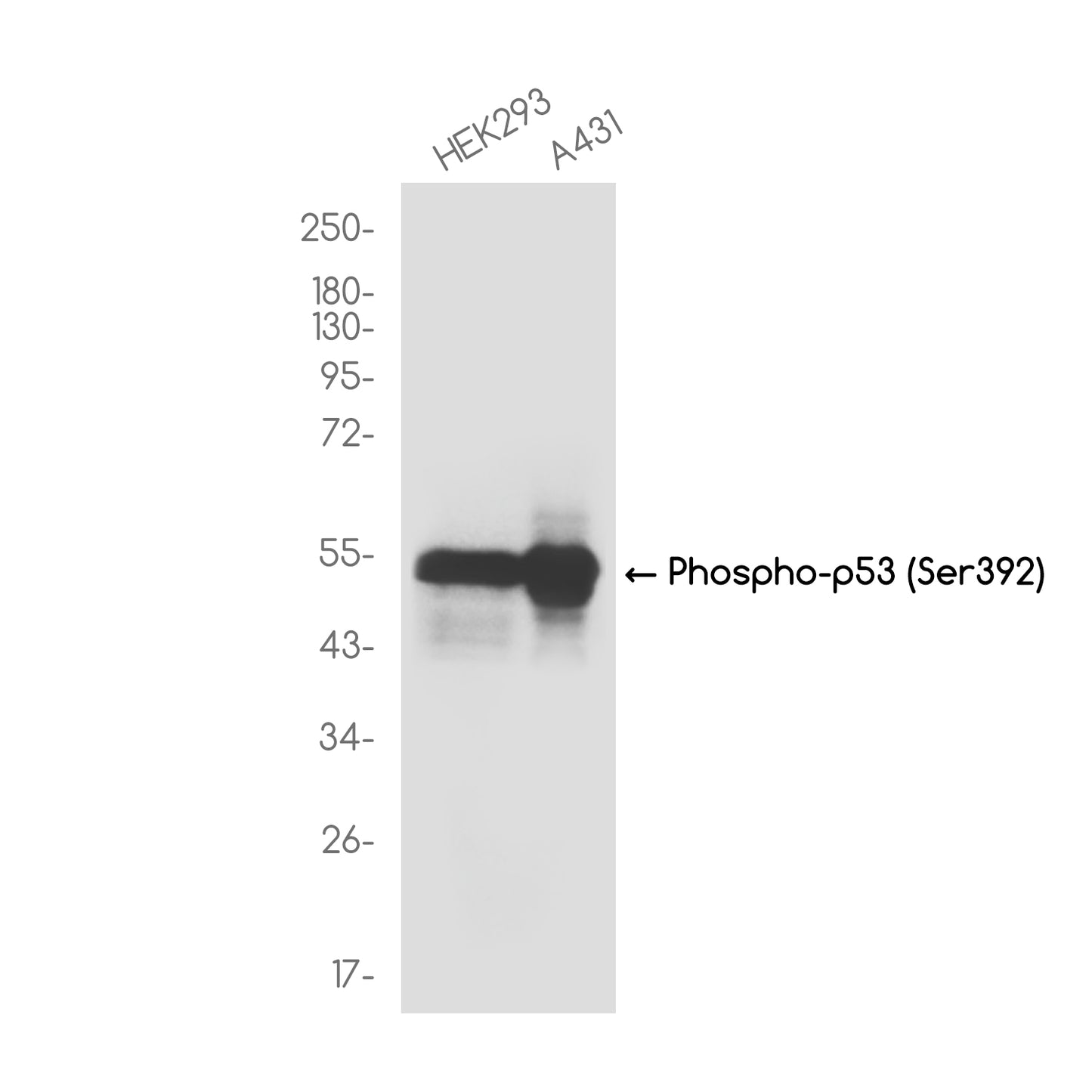 Phospho-p53 (Ser392) Rabbit Monoclonal Antibody