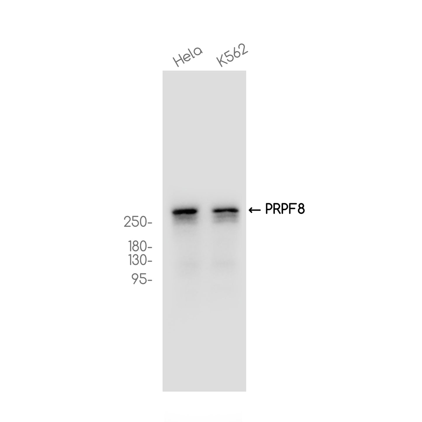 PRPF8 Rabbit Monoclonal Antibody