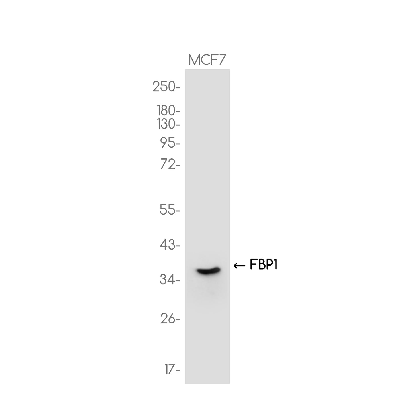 FBP1 Rabbit Monoclonal Antibody