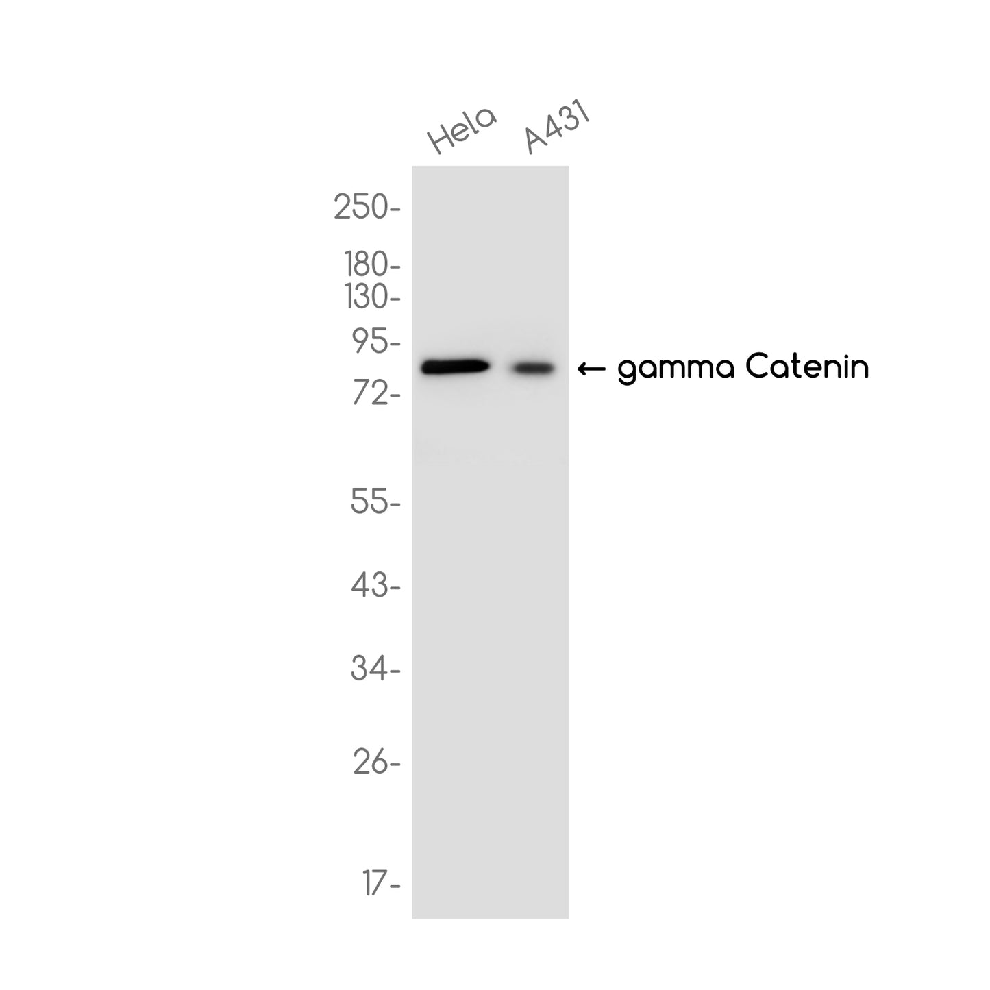 gamma Catenin Rabbit Monoclonal Antibody