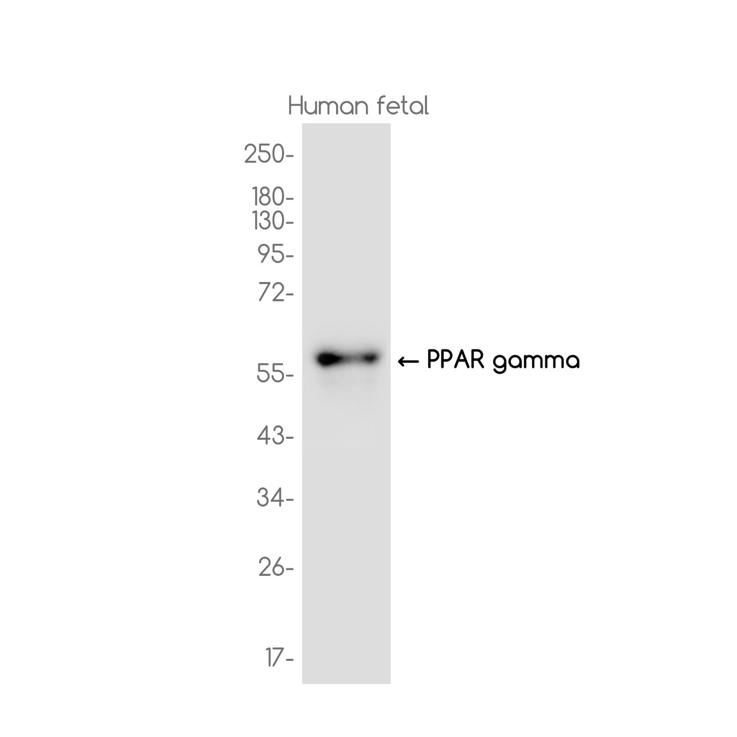 PPAR gamma Rabbit Monoclonal Antibody