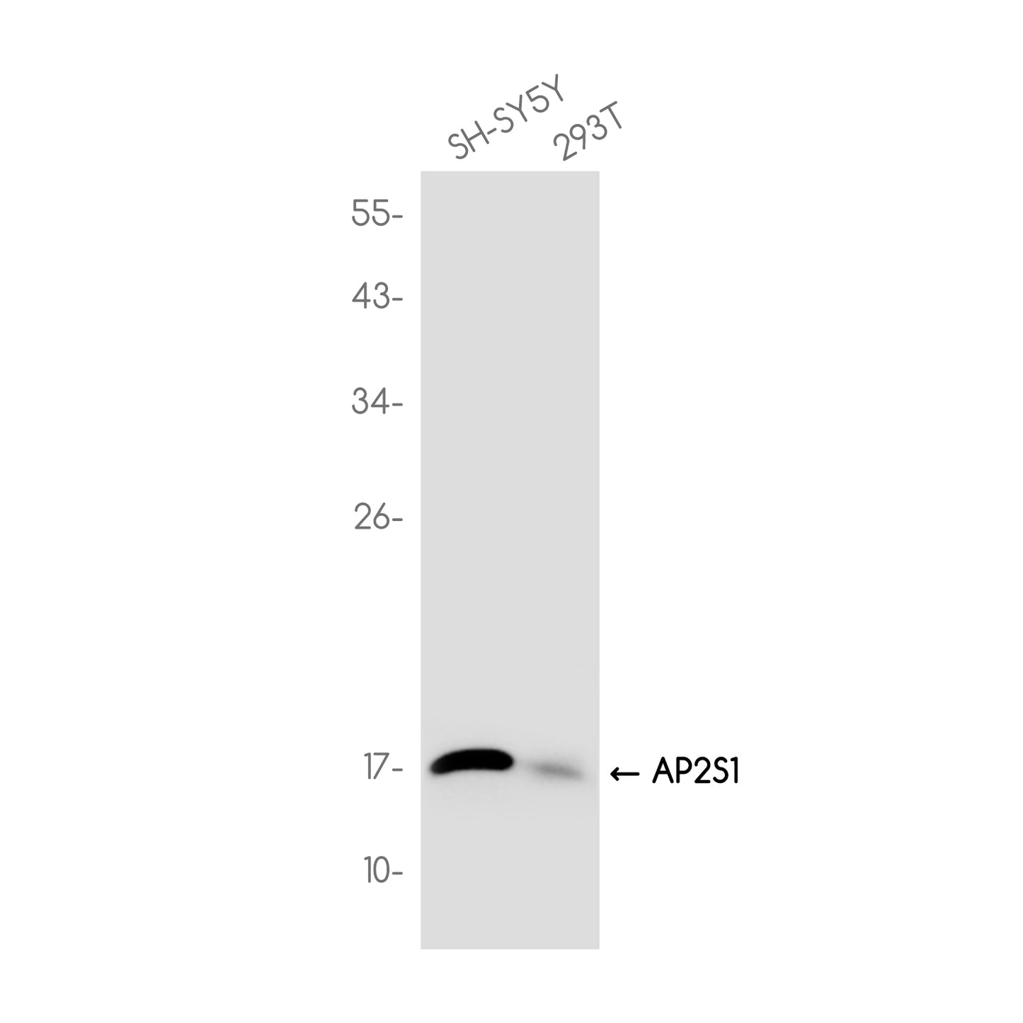 AP2S1 Rabbit Monoclonal Antibody