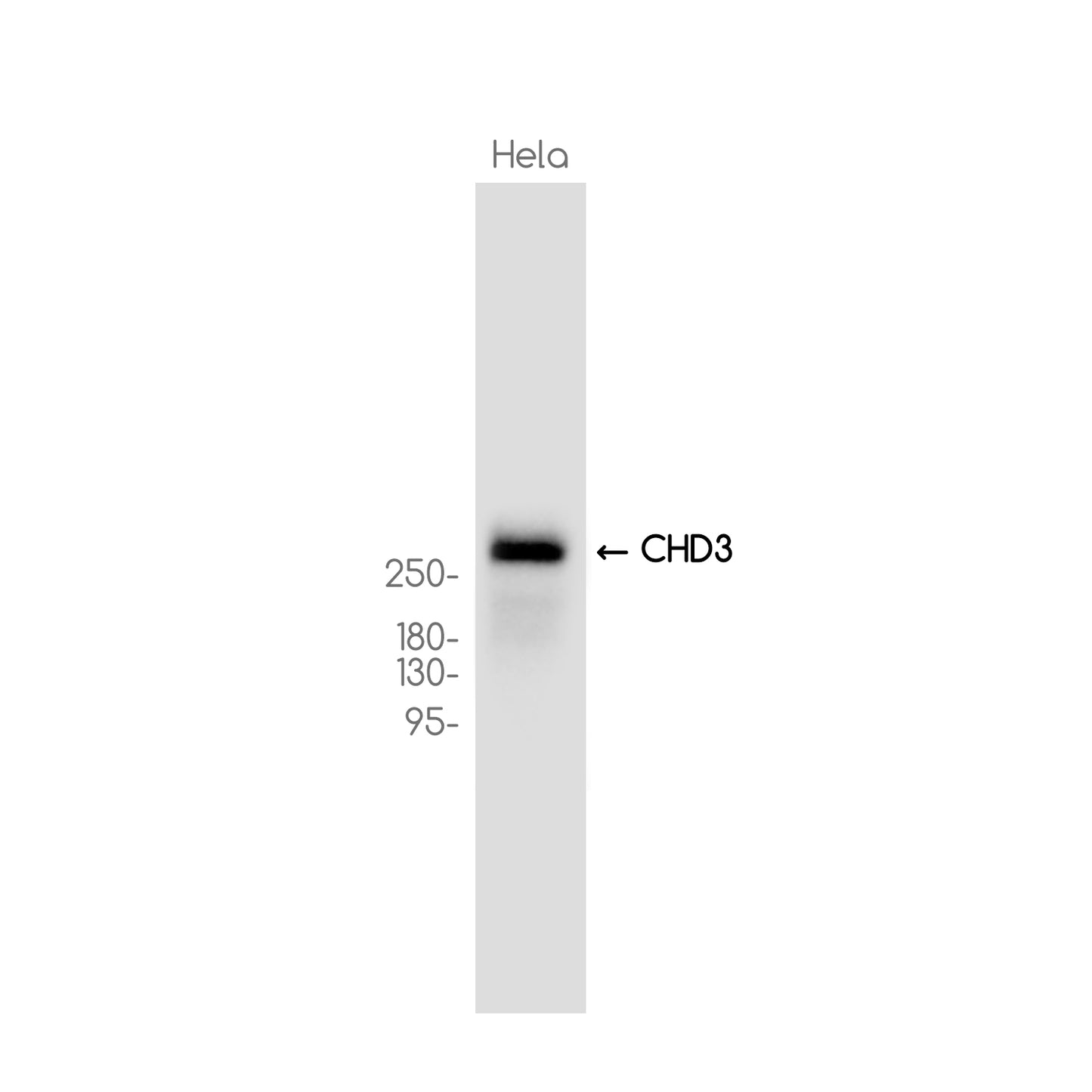 CHD3 Rabbit Monoclonal Antibody