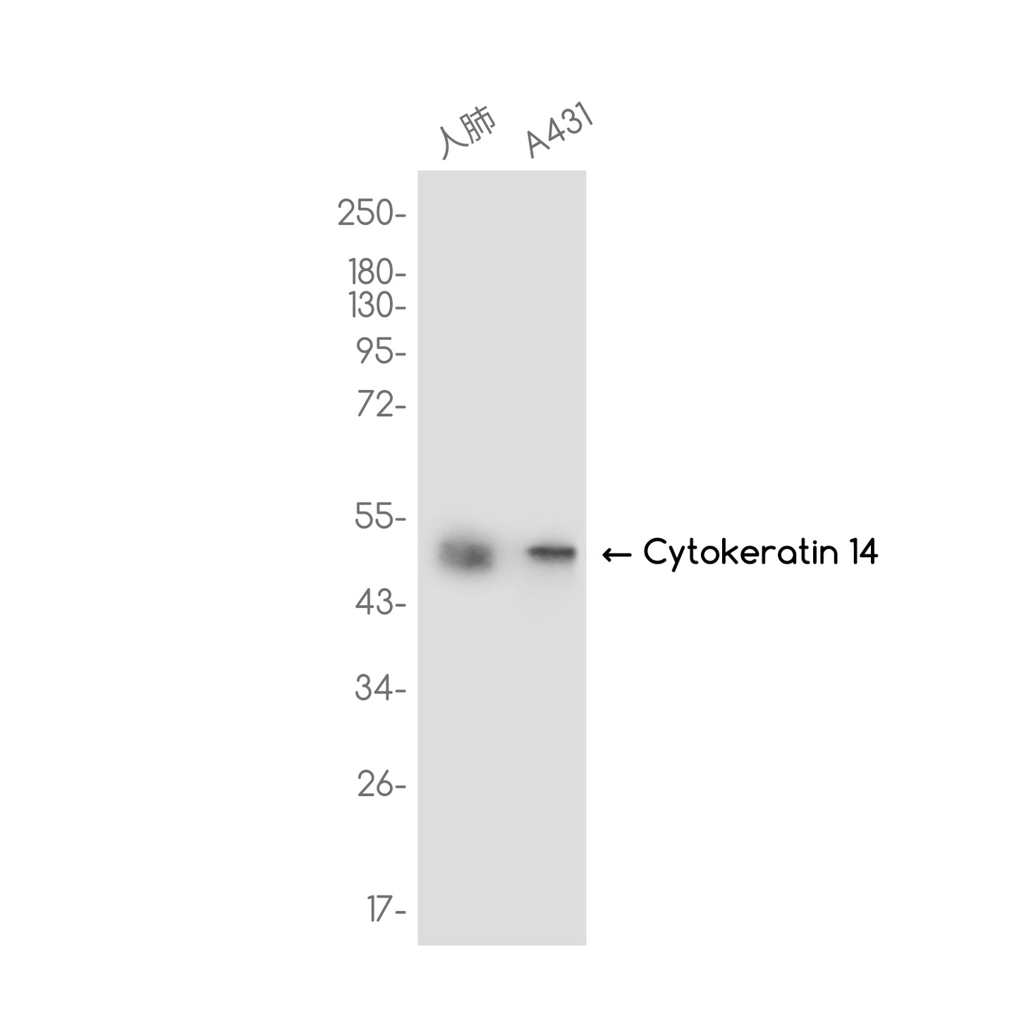 Cytokeratin 14 Rabbit Monoclonal Antibody