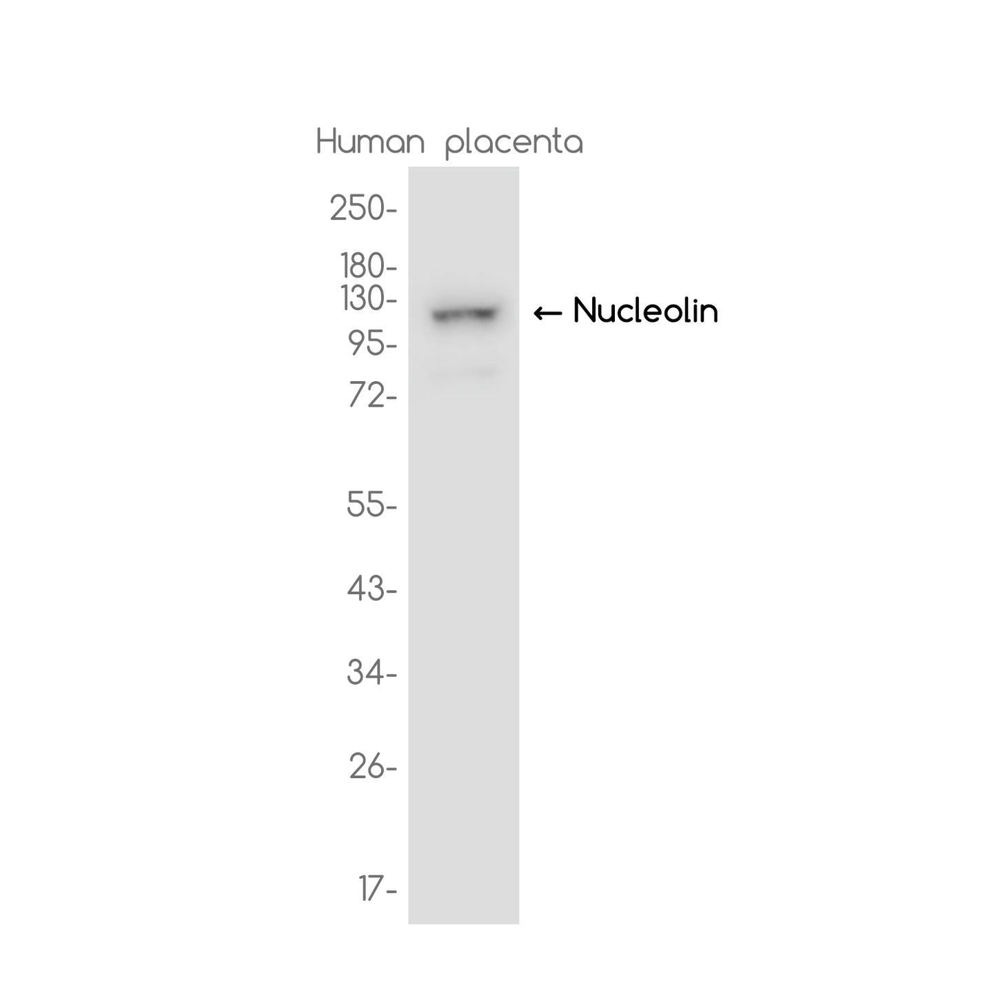 Nucleolin Rabbit Monoclonal Antibody