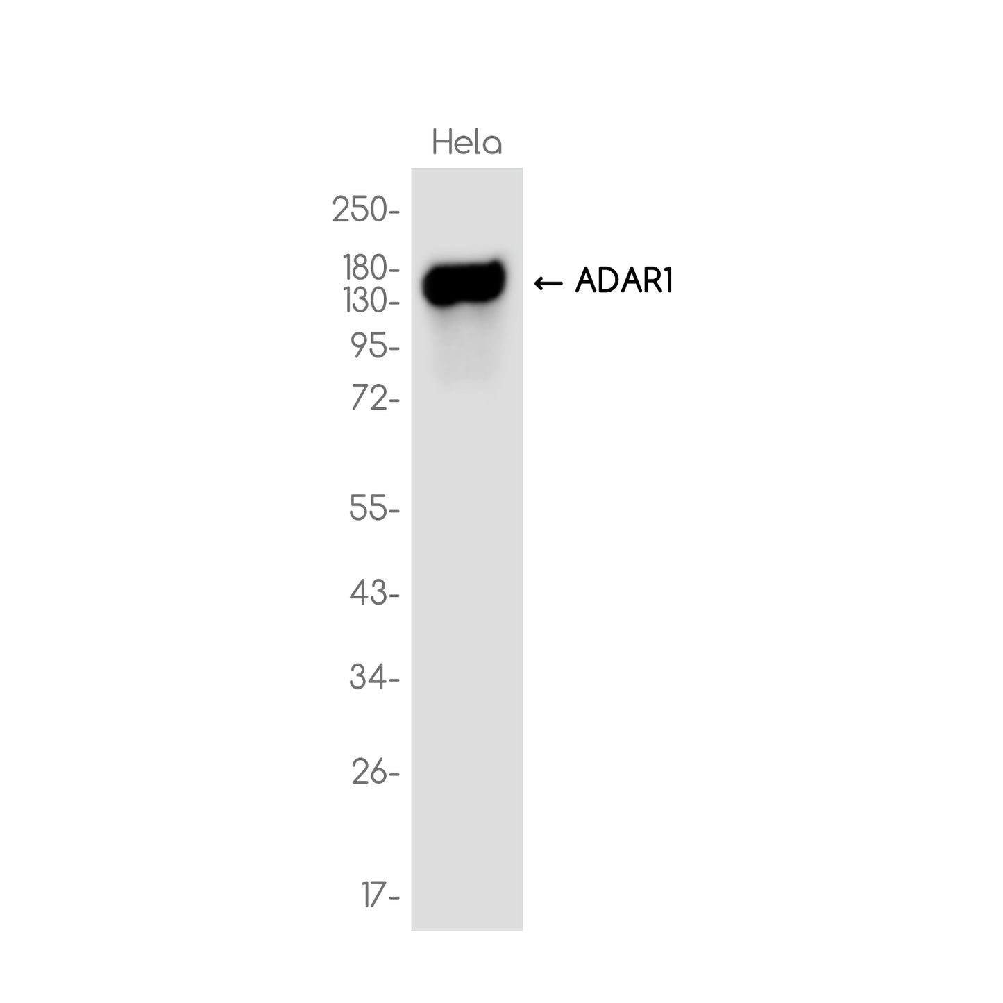 ADAR1 Rabbit Monoclonal Antibody
