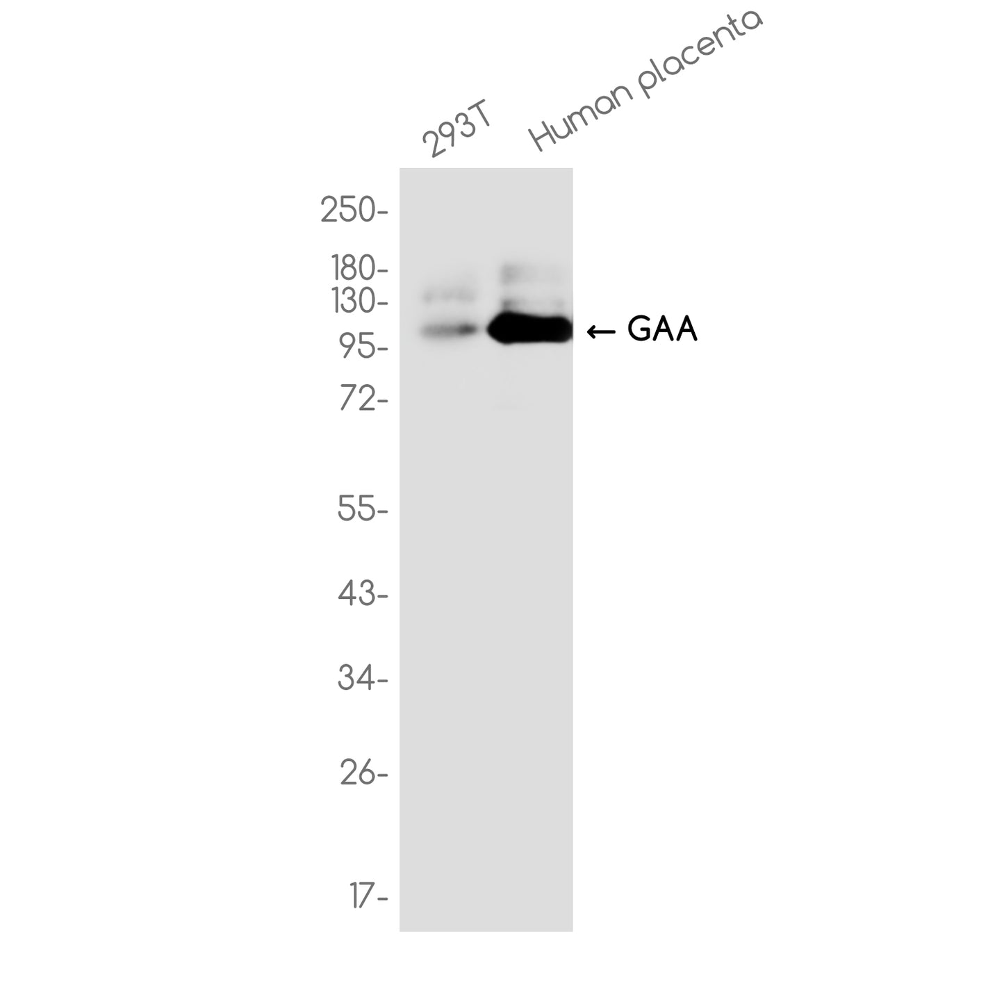 GAA Rabbit Monoclonal Antibody