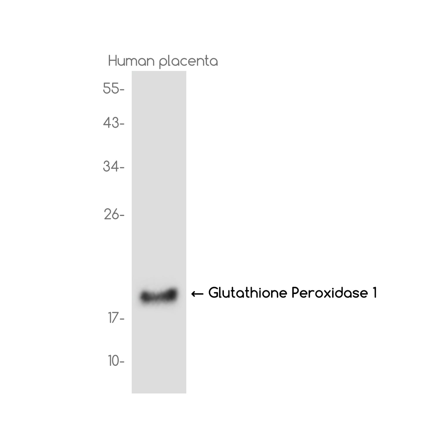 Glutathione Peroxidase 1 Rabbit Monoclonal Antibody