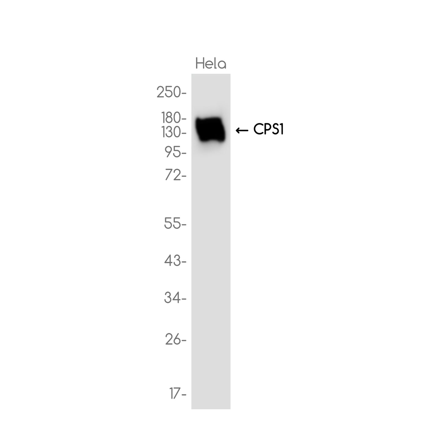 CPS1 Rabbit Monoclonal Antibody