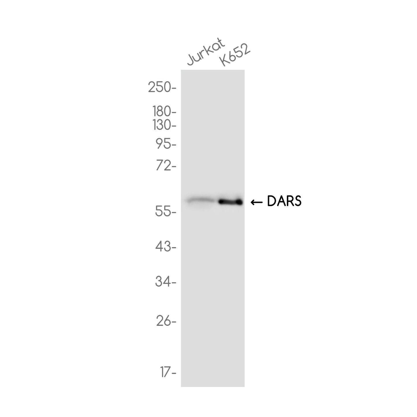 DARS Rabbit Monoclonal Antibody