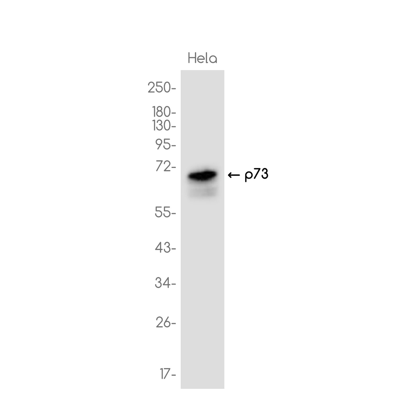 p73 Rabbit Monoclonal Antibody