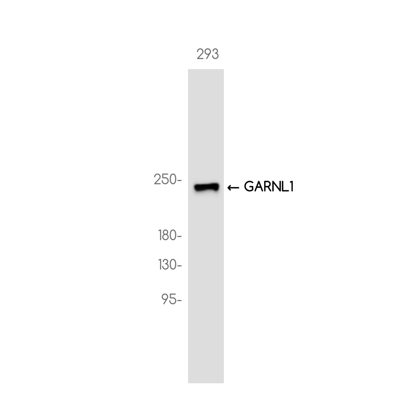 GARNL1 Rabbit Monoclonal Antibody
