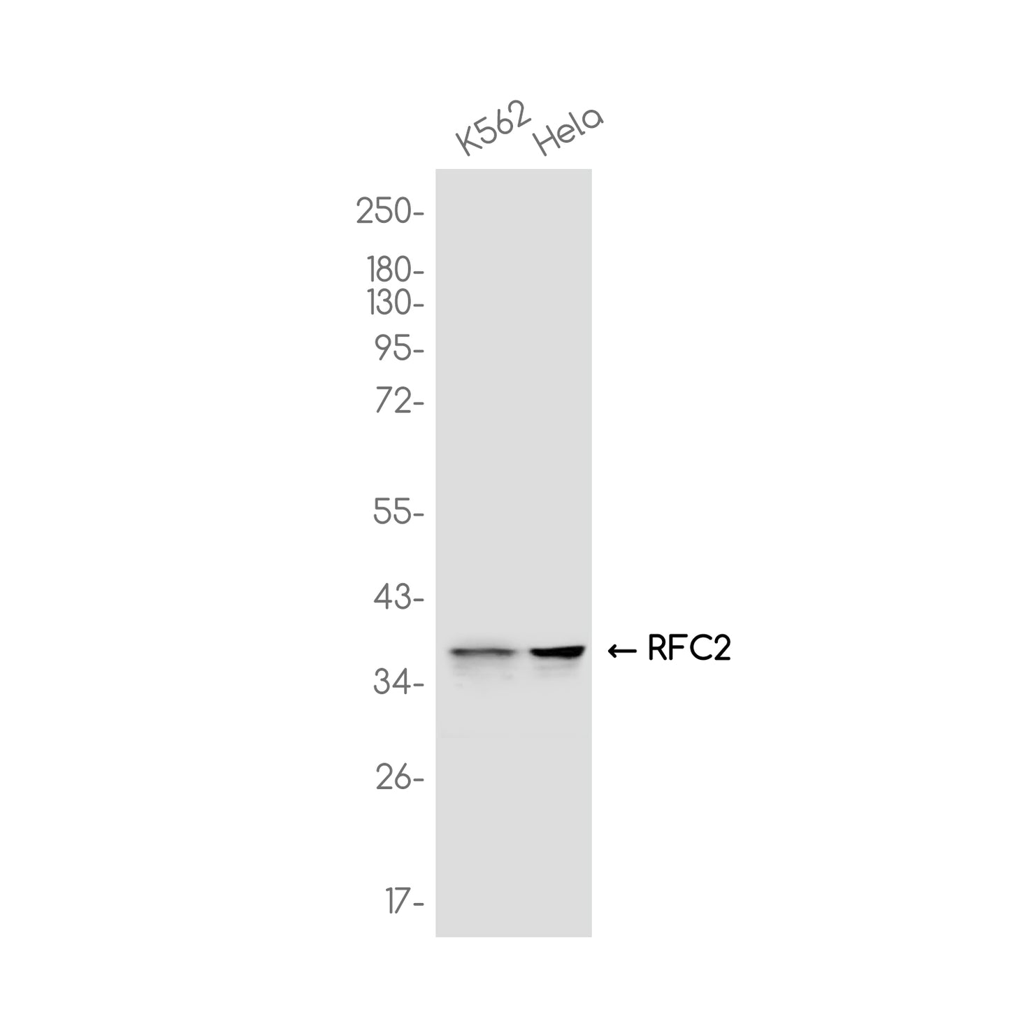 RFC2 Rabbit Monoclonal Antibody