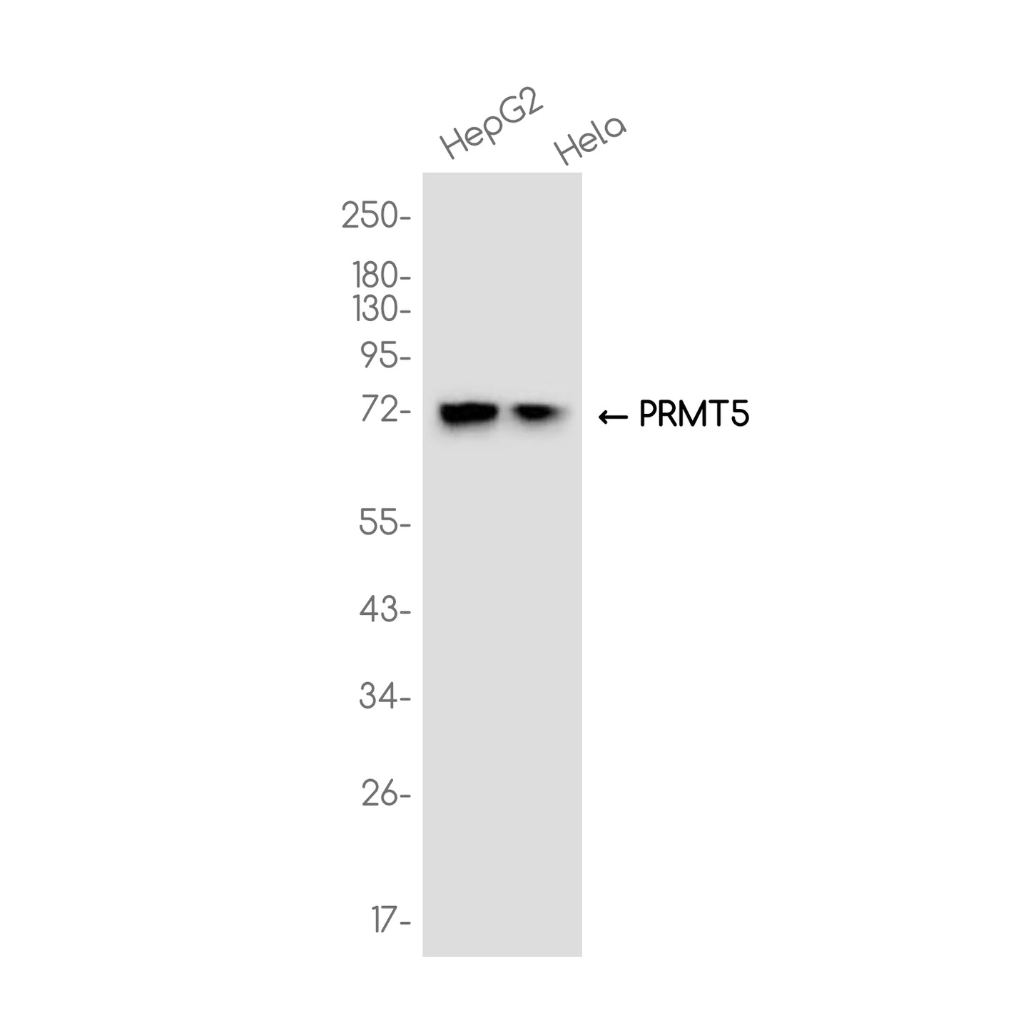 PRMT5 Rabbit Monoclonal Antibody