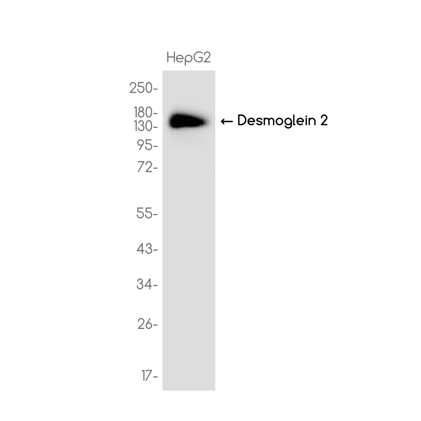 Desmoglein 2 Rabbit Monoclonal Antibody