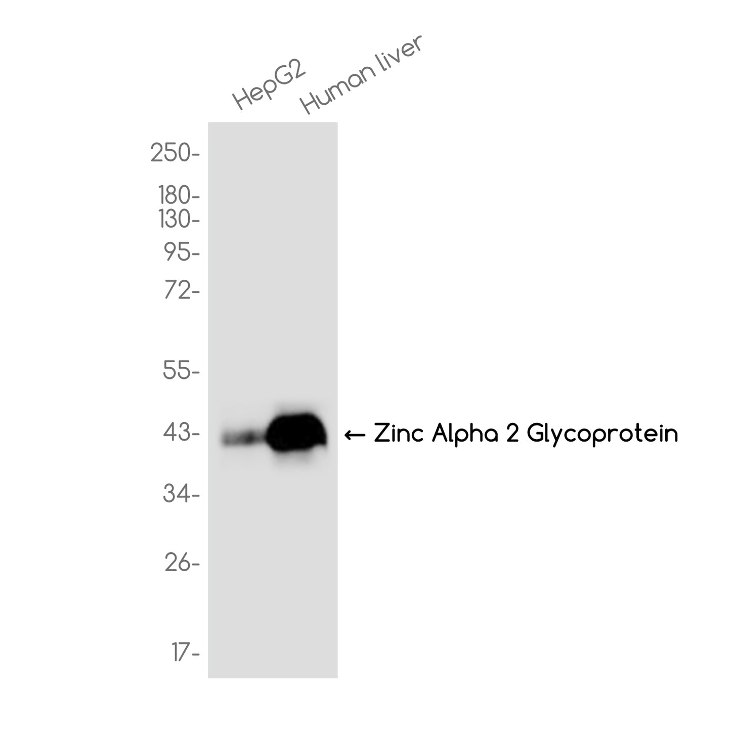 Zinc Alpha 2 Glycoprotein Rabbit Monoclonal Antibody