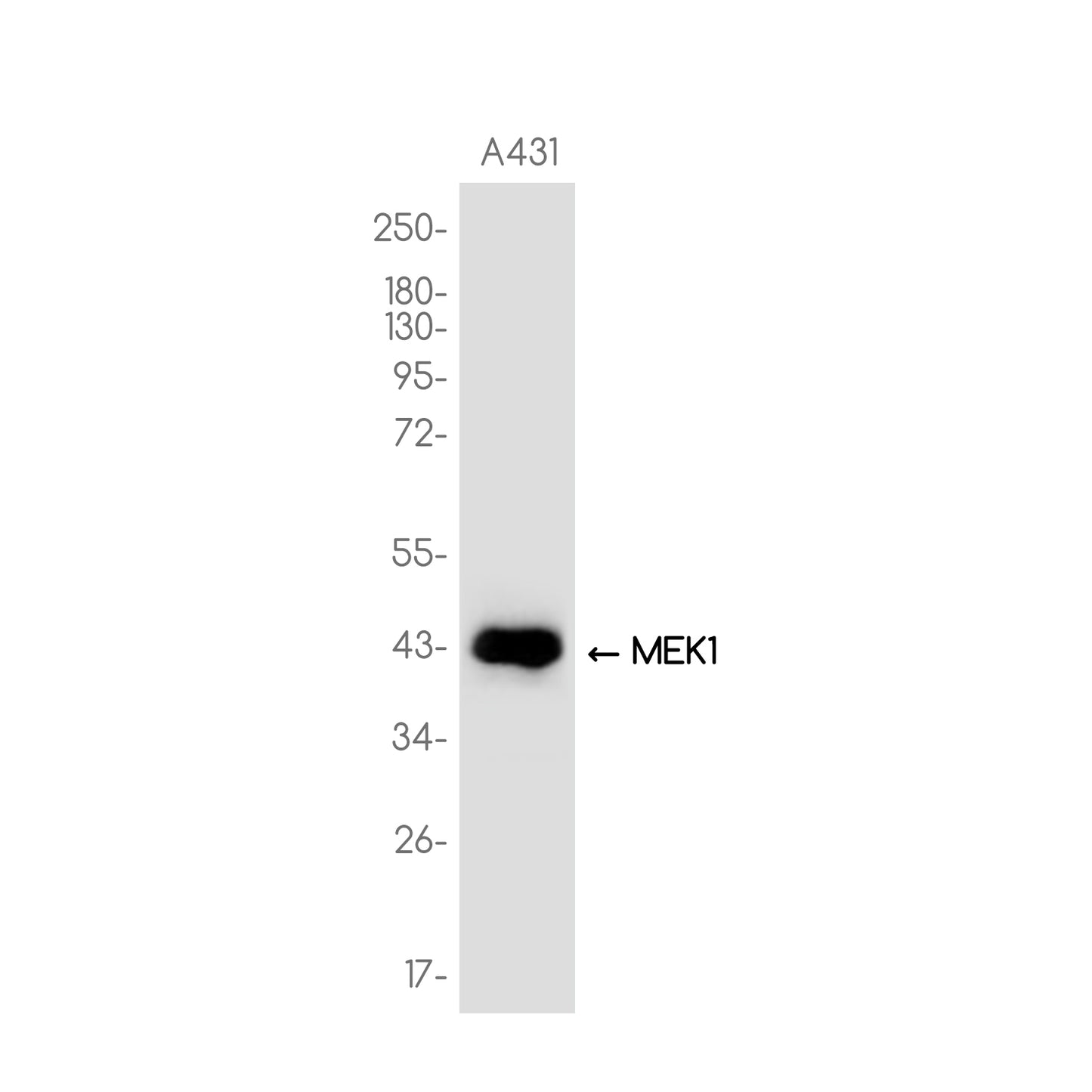 MEK1 Rabbit Monoclonal Antibody
