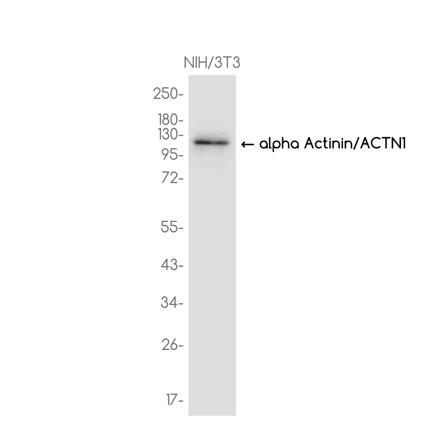 alpha Actinin/ACTN1 Rabbit Monoclonal Antibody