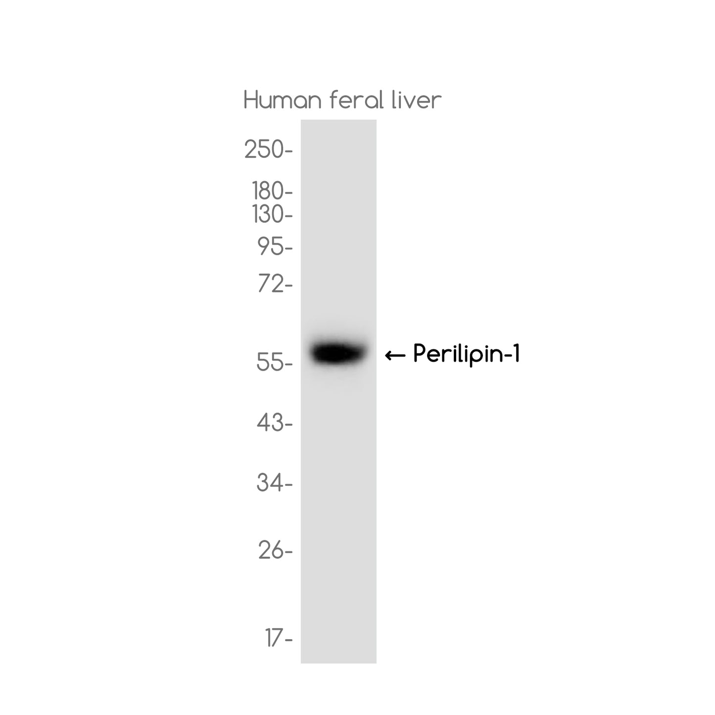 Perilipin 1 Rabbit Monoclonal Antibody