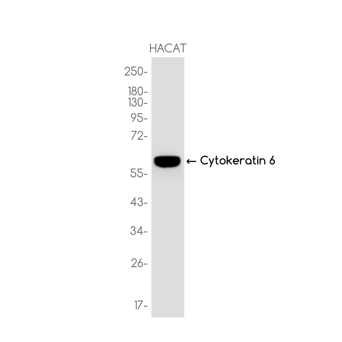 Cytokeratin 6 Rabbit Monoclonal Antibody