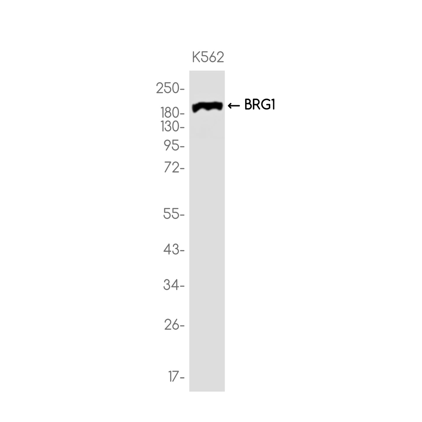 BRG1 Rabbit Monoclonal Antibody