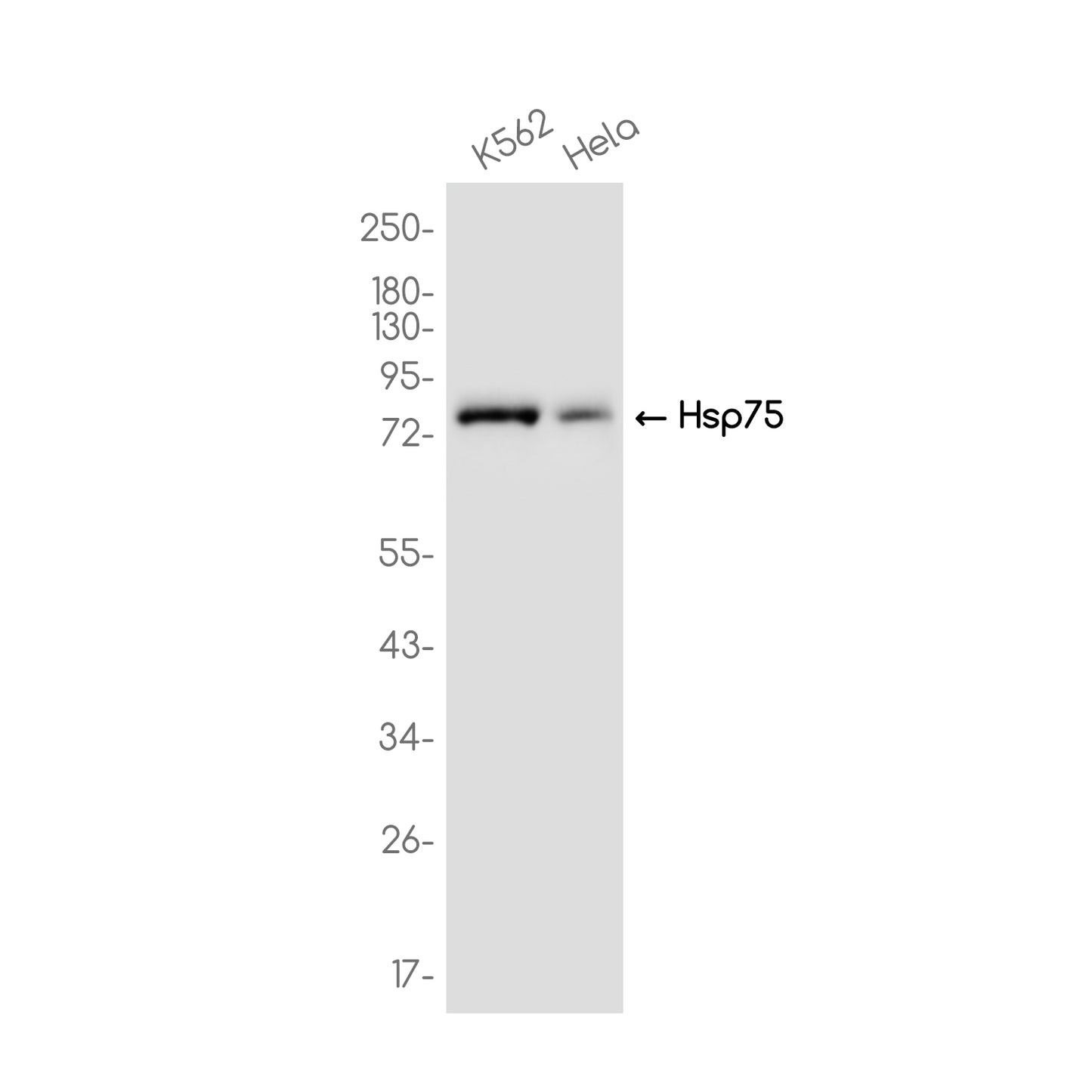 Hsp75 Rabbit Monoclonal Antibody