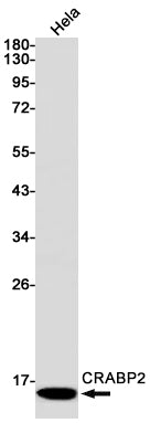 CRABP2 Rabbit Monoclonal Antibody
