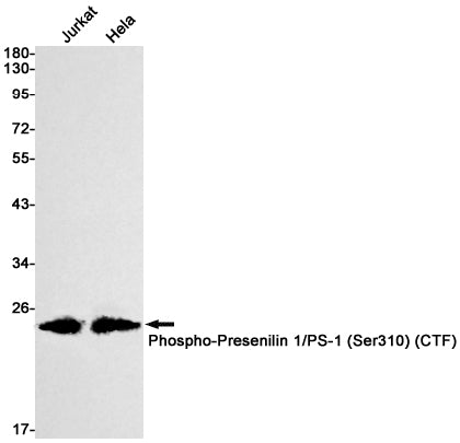 Phospho-Presenilin 1 (Ser310) Rabbit Monoclonal Antibody