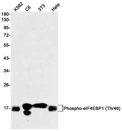 Phospho-4E BP1 (Thr46) Rabbit Monoclonal Antibody