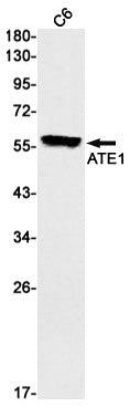 ATE1 Rabbit Monoclonal Antibody