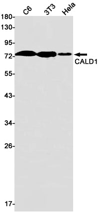 Caldesmon Rabbit Monoclonal Antibody