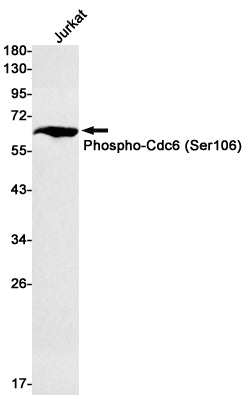 Phospho-CDC6 (Ser106) Rabbit Monoclonal Antibody