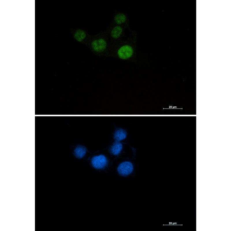 Chk2 Rabbit Monoclonal Antibody