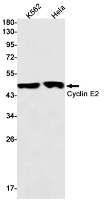 Cyclin E2 Rabbit Monoclonal Antibody