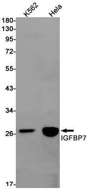 IGFBP7 Rabbit Monoclonal Antibody
