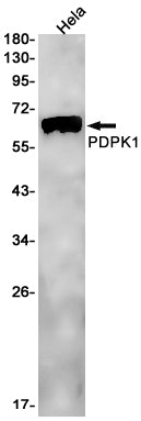PDPK1 Rabbit Monoclonal Antibody