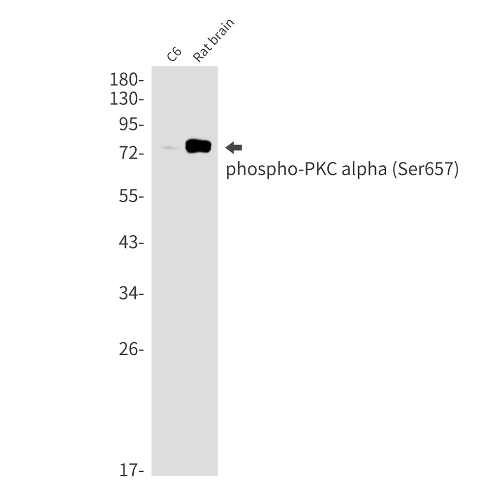 Phospho-PKC alpha (Ser657) Rabbit Monoclonal Antibody