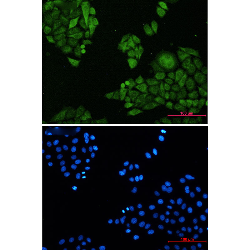 Annexin 4 Rabbit Monoclonal Antibody