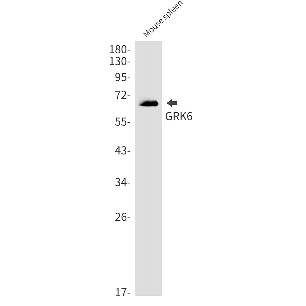 GRK6 Rabbit Monoclonal Antibody