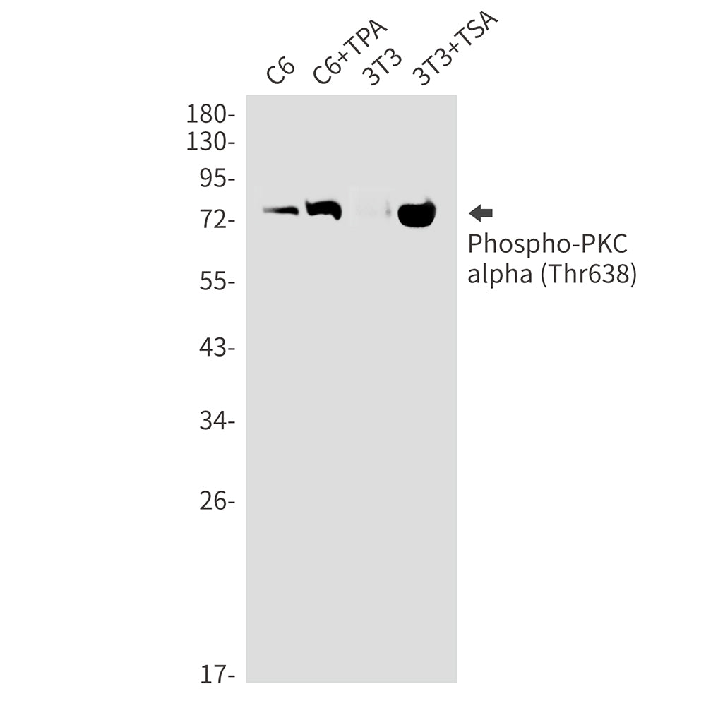 Phospho-PKC alpha (Thr638) Rabbit Monoclonal Antibody
