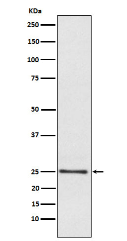 Lysophospholipase 1 (18C9) Rabbit Monoclonal Antibody