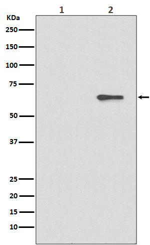 Phospho-AMPK alpha 2 (S491) (6K18) Rabbit Monoclonal Antibody