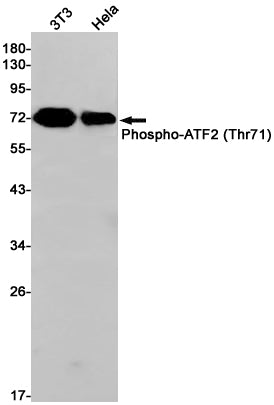 Phospho-ATF2 (T71) (7E18) Rabbit Monoclonal Antibody