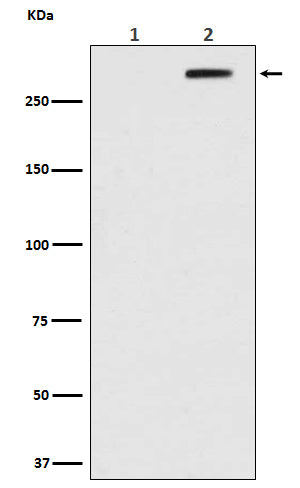 Phospho-ATM (S1981) (3F17) Rabbit Monoclonal Antibody