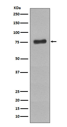 Phospho-BTK (Y223) (13X2) Rabbit Monoclonal Antibody