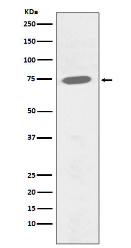 Phospho-BTK (Y551) (1W7) Rabbit Monoclonal Antibody